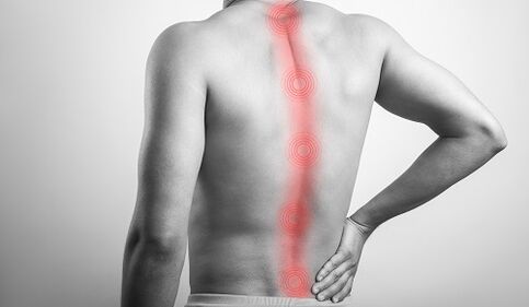 Verschiedene Rückenverletzungen führen zu Schmerzen im Lendenbereich