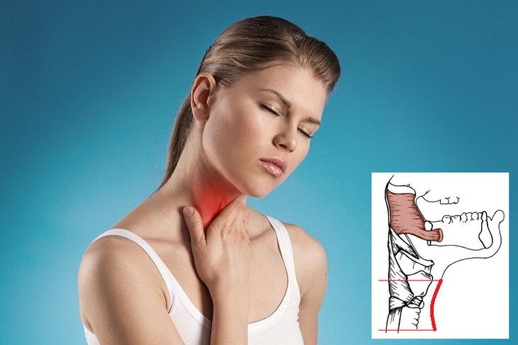 Halsschmerzen mit zervikaler Osteochondrose aufgrund von Nervenkompression