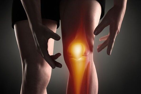 Arthrose des Kniegelenks