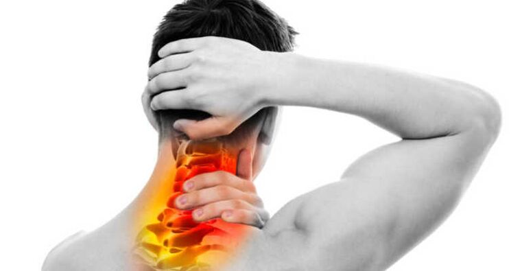 Schmerzen im Nacken- und Nackenzeichen einer Osteochondrose