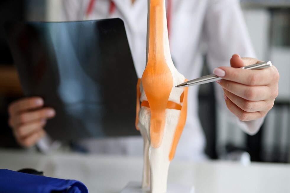 Darstellung eines Gelenks, bei dem degenerative Veränderungen zur Entstehung einer Arthrose führen
